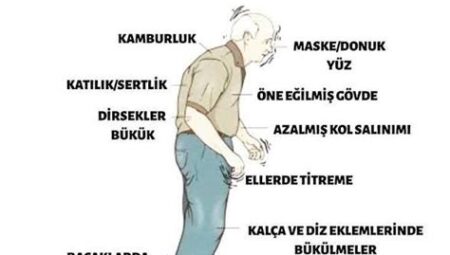 Parkinson Hastalığı Belirtileri ve Tedavisi